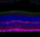U17. Micorscopy- Immunohistochemical labeling of the mouse retina.
